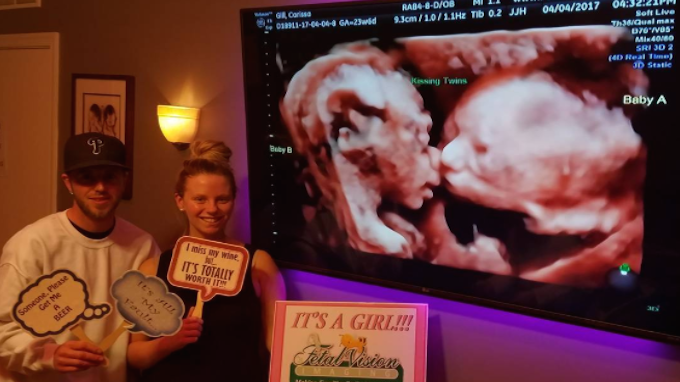 Carissa Gill dan pasangannya saat melihat hasil USG.