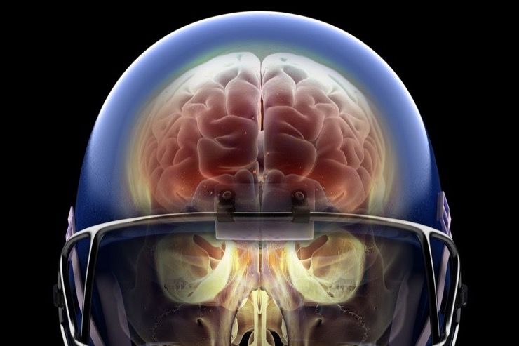 what-is-concussion-queensland-brain-institute-university-of-queensland