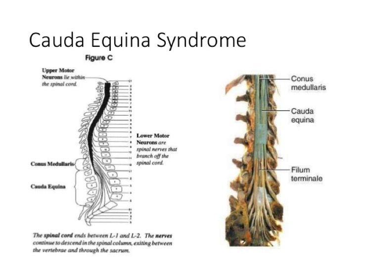 Why You Need To Pay Attention To Sciatic Nerve Health | LifeDaily
