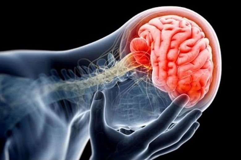 Everything You Need To Know About Concussions Lifedaily 