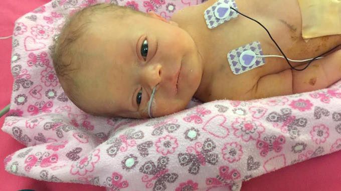 Fiona Grace yang penuh mukjizat. Facebook/Autumn Joy Dunn