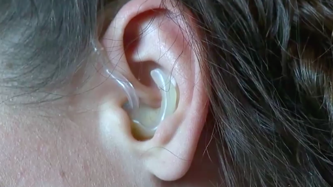 Alat bantu dengar yang dimiliki Carlson. 