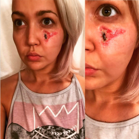 Kondisi wajah Meghan Linsey