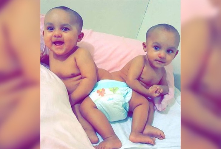 Family Gives Up Everything To Separate Conjoined Twins | LifeDaily