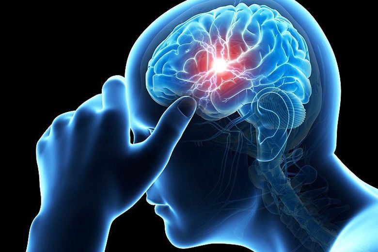 38 Important Signs And Symptoms Of A Concussion You’re Probably ...