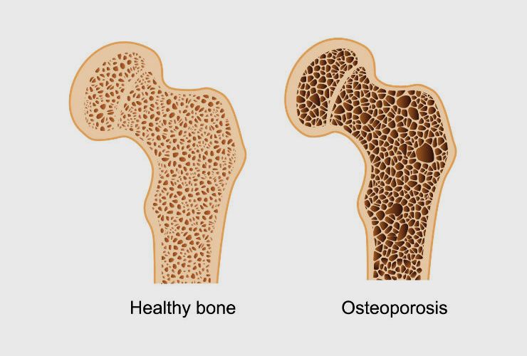 Why Potassium Is One Of The Most Important Chemicals In The Human Body ...