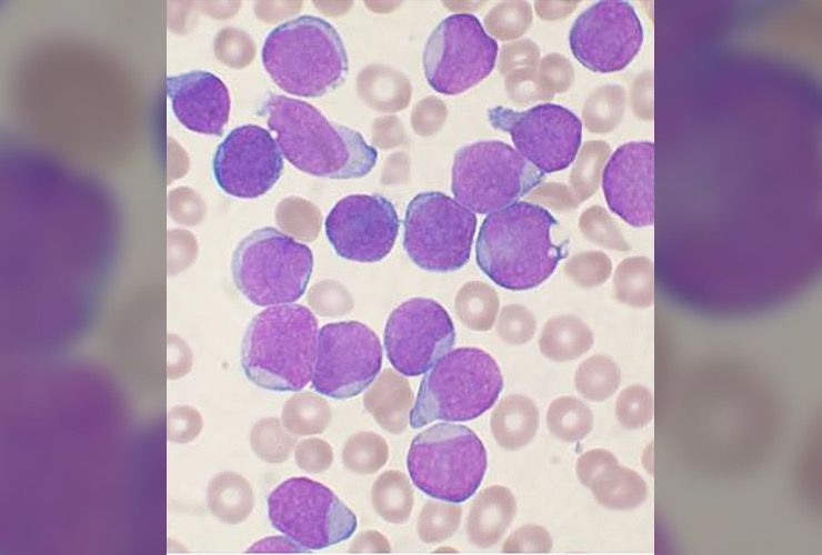 Common Types of Cancer Story